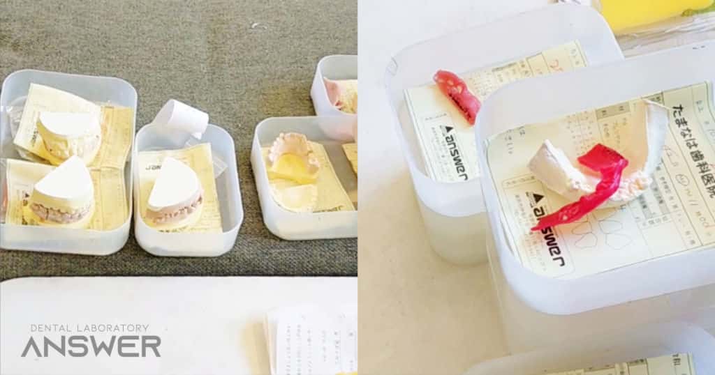 สุดยอดฝีมือการทำฟันปลอมจากญี่ปุ่น ที่ ANSWER LAB โอกินาว่า